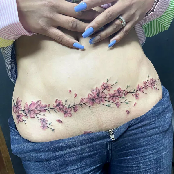 Tummy tuck scar tattoo 29