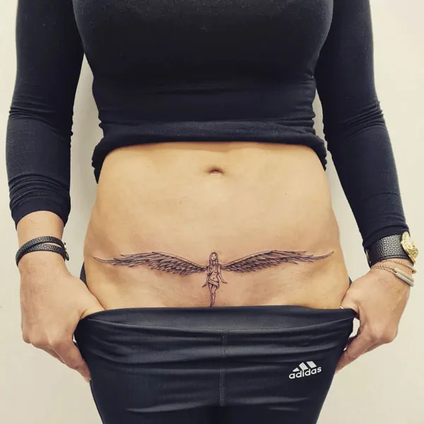 Tummy tuck scar tattoo 31