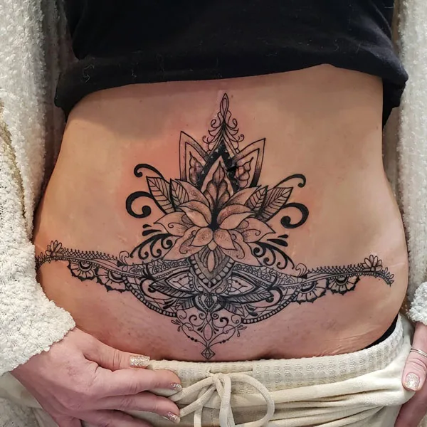 Tummy tuck scar tattoo 6